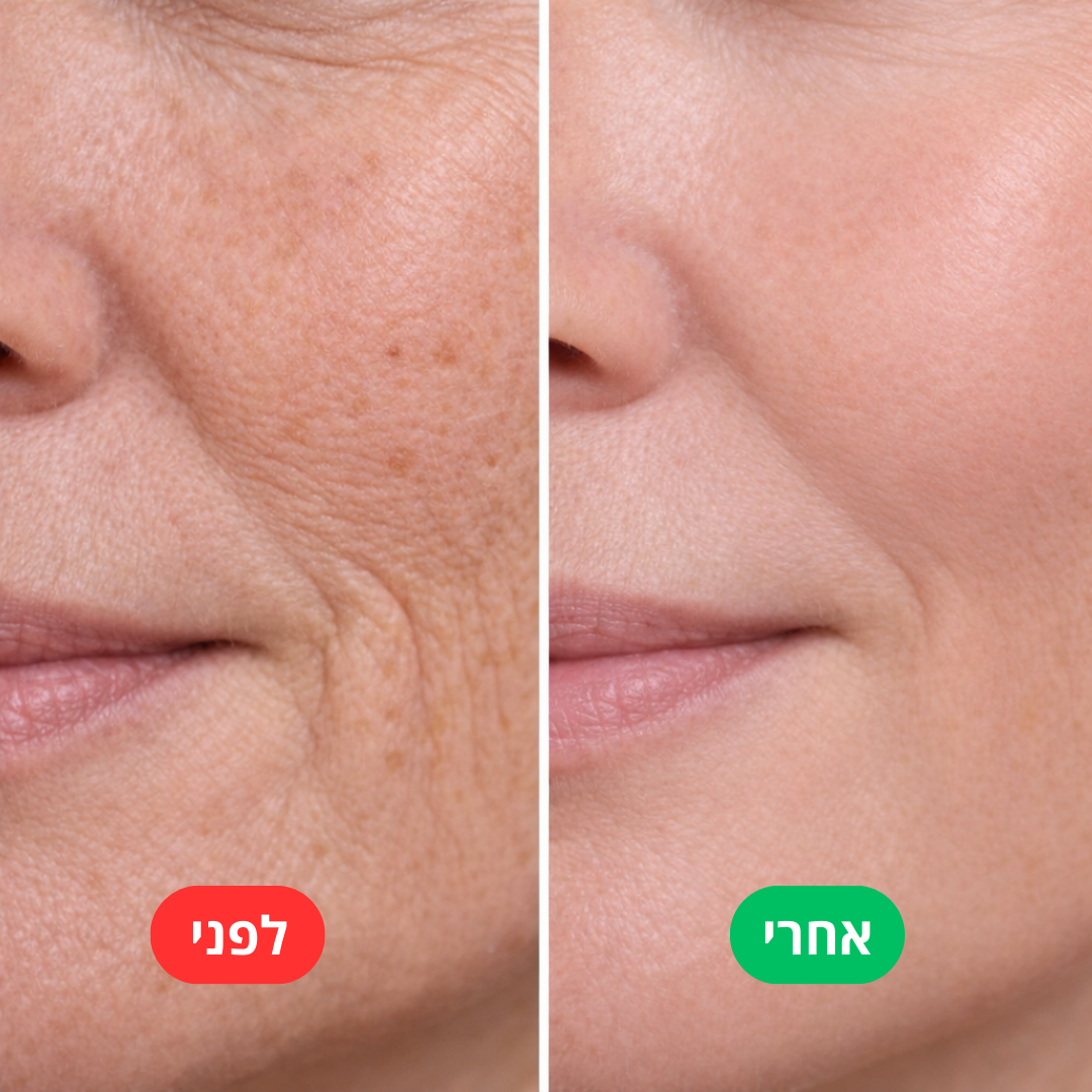 משקם העור - kora™