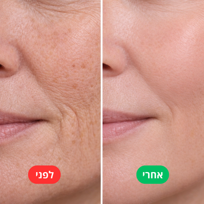 משקם העור - kora™