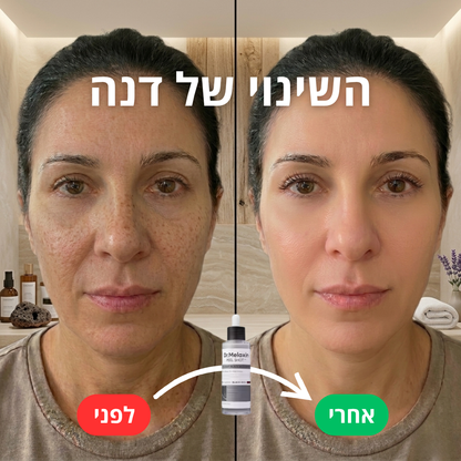 סרום השחורים- PEEL SHOT™