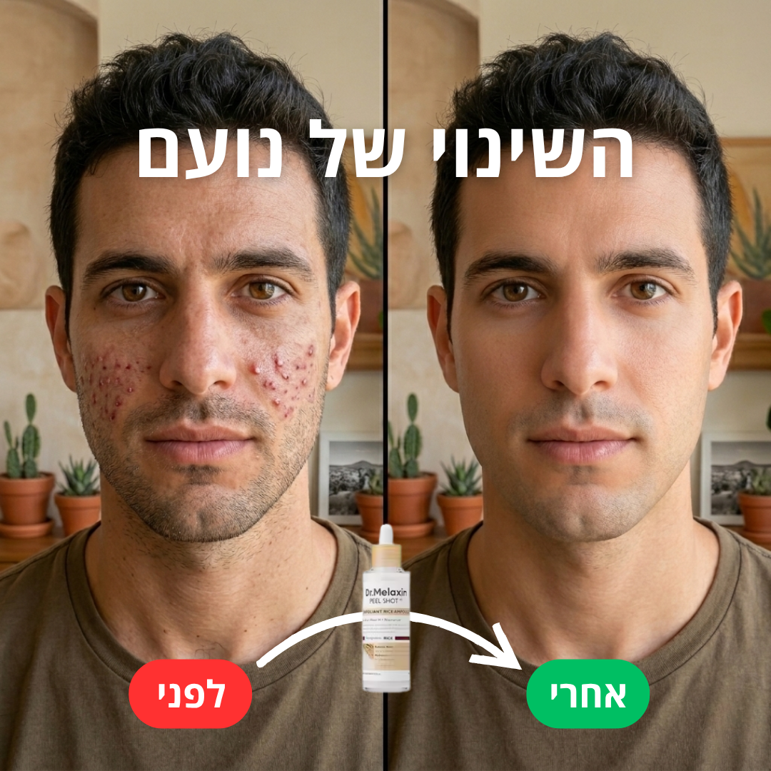 סרום השחורים- PEEL SHOT™